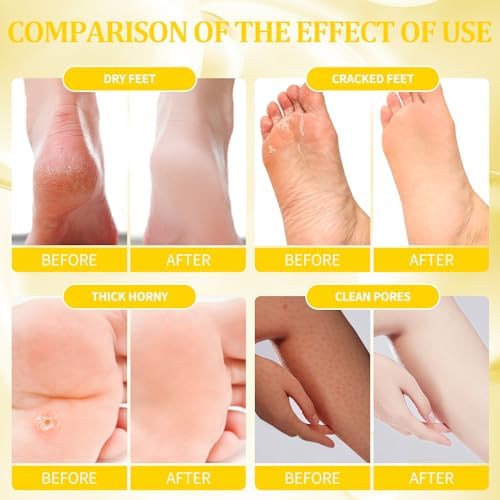 Pedicure Kit Foot Soak Set: Bubble Salt, Sugar Scrub, Massage Mask, Massage Lotion in a Box, 4 Step Foot Spa Kit for Dry Feet, Calluses and Tired Feet(1 Set Milky Flower) - Image 3