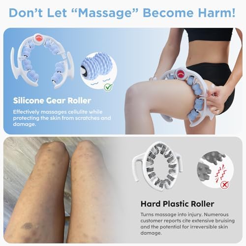 Cellulite Massage Tool - Lymphatic Drainage Massager - Muscle Roller, Deep Fascia Massage, Dimpled Skin Removal, Legs/Thighs/Buttocks, Anti-Cellulite Roller, Smooth Skin (14 Wheel - Blue) - Image 2