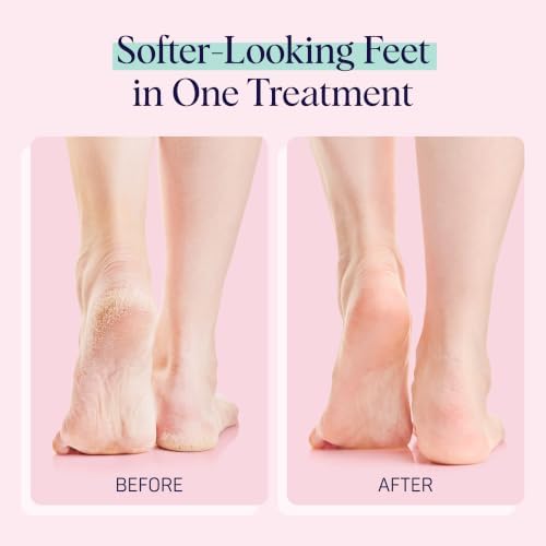 SpaLife Moisturizing Foot Sockies | Foot Mask for Dry Cracked Feet | Tea Tree Oil Softening Booties | Callus Remover Alternative | Self Care Gifts for Women | 8 Pack - Image 4