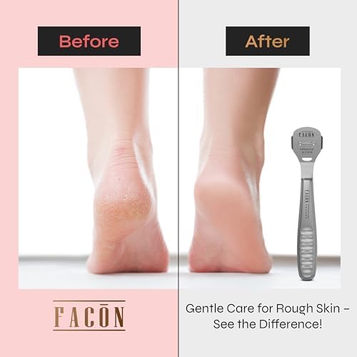 Facón Professional Callus Shaver Remover with 50 Blades, Pedicure Razor for Feet & Hands, Foot Razor for Callus Removal, Callus Blade Remover, Corn Shaver, Surgical Grade Premium Stainless Steel Tool - Image 3