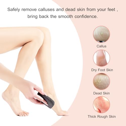 SAMEBUTECO 3 Shapes Natural Volcanic Pumice Stone for Feet Pumice Cleaning Stone for Sole of The Foot,Edges of The Foot,Toe Seams,Foot Scrubber for Dead Skin Remover Deep Clean - Image 5