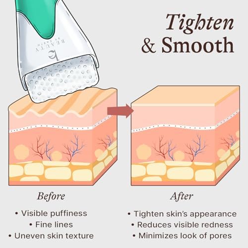 Ice Roller for Face - Face & Eye Roller for Puffy Eyes & Wrinkles - Image 3