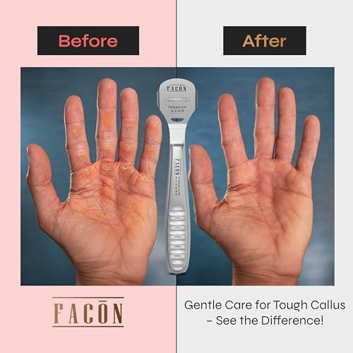 Facón Professional Callus Shaver Remover with 50 Blades, Pedicure Razor for Feet & Hands, Foot Razor for Callus Removal, Callus Blade Remover, Corn Shaver, Surgical Grade Premium Stainless Steel Tool - Image 4