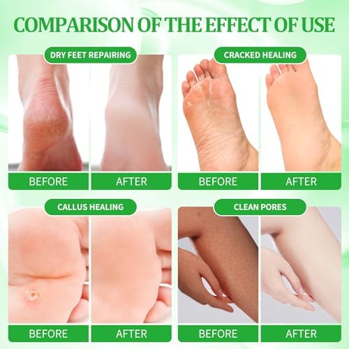 Pedicure Kit Foot Soak Set: Bubble Salt, Sugar Scrub, Massage Mask, Massage Lotion in a Box, 4 Step Foot Spa Kit for Dry Feet, Calluses and Tired Feet(3 Set Jasmine) - Image 3