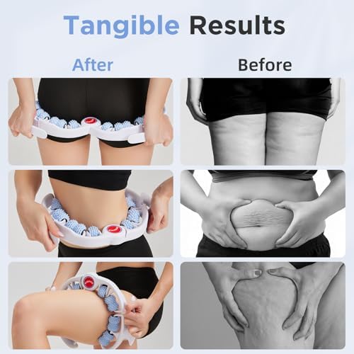 Cellulite Massage Tool - Lymphatic Drainage Massager - Muscle Roller, Deep Fascia Massage, Dimpled Skin Removal, Legs/Thighs/Buttocks, Anti-Cellulite Roller, Smooth Skin (14 Wheel - Blue) - Image 3