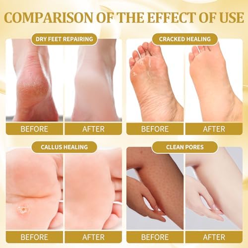 Pedicure Kit Foot Soak Set: Bubble Salt, Sugar Scrub, Massage Mask, Massage Lotion in a Box, 4 Step Foot Spa Kit for Dry Feet, Calluses and Tired Feet(1 Set Honey Flower) - Image 3