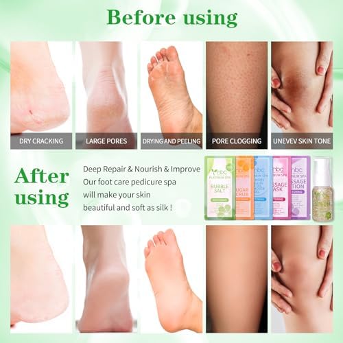 Pedicure Foot Soak Set - Upgraded 6 in 1 Foot Spa, Foot Bath Spa, Pedicure Kit, Foot Soak for Tired & Dry Cracked Feet, Athletes Feet, Bad Odor, Softens Calluses (Jasmine) - Image 3