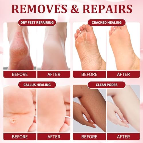 Pedicure Kit Foot Soak Set: Bubble Salt, Sugar Scrub, Massage Mask, Massage Lotion in a Box, 4 Step Foot Spa Kit for Dry Feet,Tired Feet (1 Set Pomegranate) - Image 3
