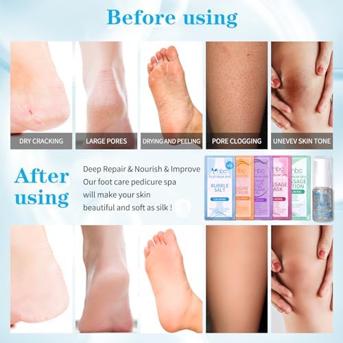 Pedicure Foot Soak Set - Upgraded 6 in 1 Foot Spa, Foot Bath Spa, Pedicure Kit, Foot Soak for Tired & Dry Cracked Feet, Athletes Feet and Calluses (Pacific Waves) - Image 3