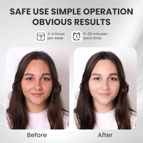 7-1 Colors Red Light Therapy For Face，LED Facial Skin Care Mask,Red Light Mask for Face, LED Facial Mask Light,Salon or Home,White. - Image 4