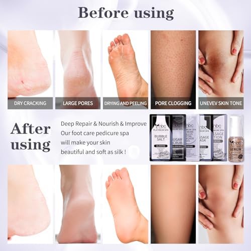 Pedicure Foot Soak Set - Upgraded 6 in 1 Foot Spa, Foot Bath Spa, Pedicure Kit, Foot Soak for Tired & Dry Cracked Feet, Athletes Feet, Bad Odor, Softens Calluses,Golden Petals - Image 3