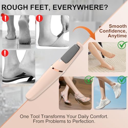 2026 Pro Electric Foot File,Callus Remover for Feet - Image 3