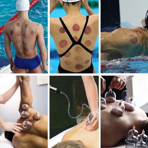 DEFUNX Cupping Set, 24 Cups Cupping Kit for Massage Therapy, Cupping Therapy Set with Pump for Back Massage, Pain Relief, Physical Therapy - Image 6