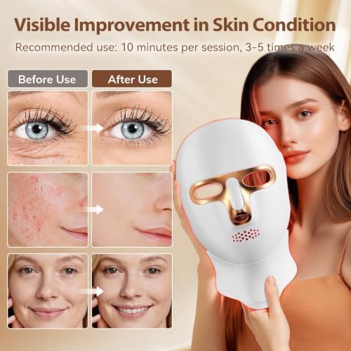 ONLUKY Red Light Therapy Mask USB-C Rechargeable LED Face Mask - Image 3