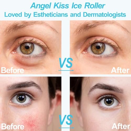 Angel Kiss Ice Roller for Face Eye - Women Gift Idea - Facial Massage Tool - Image 5
