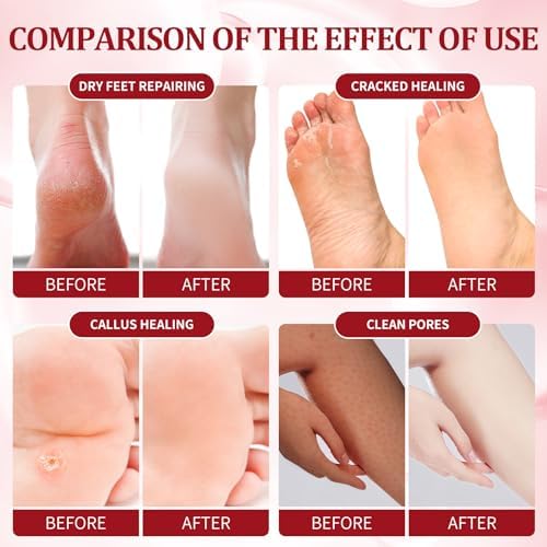 Pedicure Kit Foot Soak Set: Bubble Salt, Sugar Scrub, Massage Mask, Massage Lotion in a Box, 4 Step Foot Spa Kit for Dry Feet,Tired Feet（3 Set Pomegranate) - Image 3
