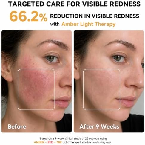 Red Light Therapy for Face Mask, Blue Light Therapy for Acne, Gifts for Women, Wrinkle LED Face Mask, 432 LED with Full Face Coverage & 3 Light Modes, Travel Bag for Home Use & Travel, Black - Image 3