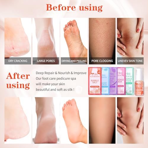 Pedicure Foot Soak Set - Upgraded 6 in 1 Foot Spa, Foot Bath Spa, Pedicure Kit, Foot Soak for Tired & Dry Cracked Feet, Athletes Feet, Bad Odor, Softens Calluses (Tropical fruit) - Image 3