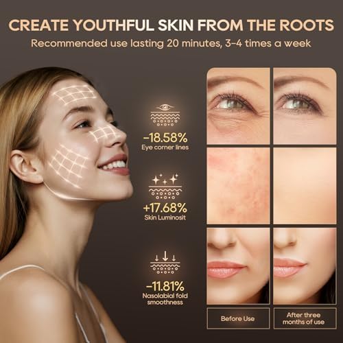 Morfone Red Light Therapy Mask for Fcae，4 Modes, Infrared Skin Care Device - Image 4