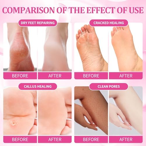 Pedicure Kit Foot Soak Set: Bubble Salt, Sugar Scrub, Massage Mask, Massage Lotion in a Box, 4 Step Foot Spa Kit for Dry Feet, Softens Calluses, Soothes Sore, Tired Feet（3 Set Rose - Image 3