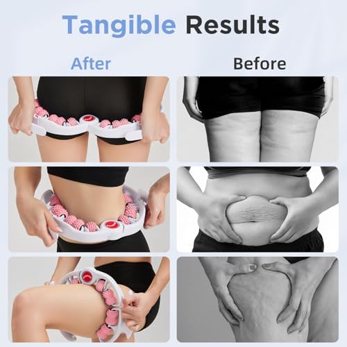 Cellulite Massage Tool - Lymphatic Drainage Massager - Muscle Roller, Deep Fascia Massage, Dimpled Skin Removal, Legs/Thighs/Buttocks, Anti-Cellulite Roller, Smooth Skin (14 Wheel - Pink) - Image 2