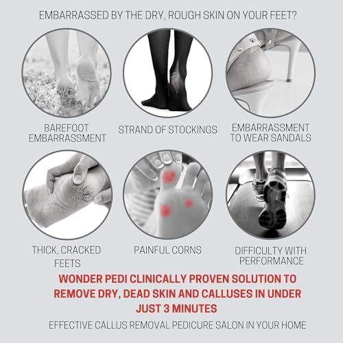 Feet Callus Remover Softener Spray, Gentle Fast-Acting Formula - Image 2