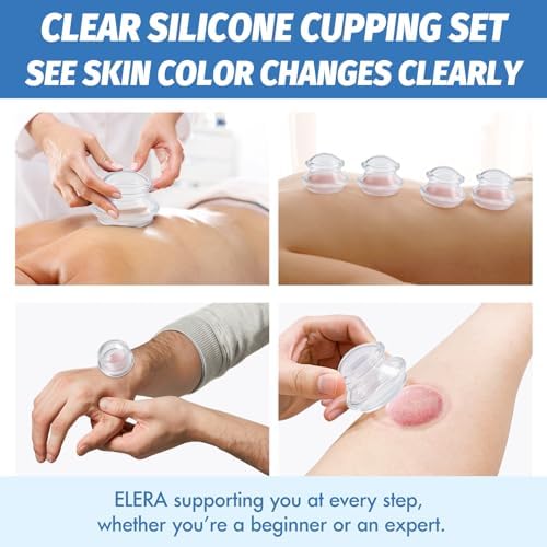 ELERA Silicone Cupping Therapy XL Size Sets, Professionally Chinese Massage Cups Tools, Silicone Cup for Joint Pain Relief, Massage Body (XL*2 Cups) - Image 4