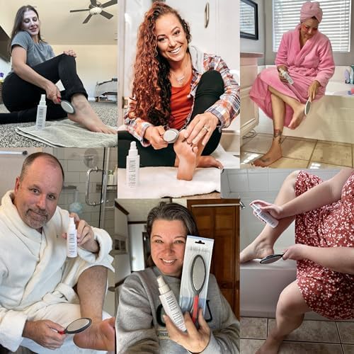 Feet Callus Remover Softener Spray, Gentle Fast-Acting Formula - Image 4