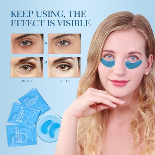 Yeokoe Under Eye Patches for Dark Circles,Puffy Eyes,20 Pairs Face Masks SkinCare With Hyaluronic Acid Witch Hazel for Moisturize - Image 3