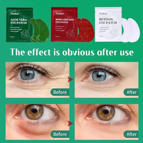 Yeokoe Under Eye Patches For Puffy Eyes and Dark Circles Wrinkle,30 Pairs Face Masks SkinCare With Retinol Serum,Aloe Vera,Rose Betaine - Image 4