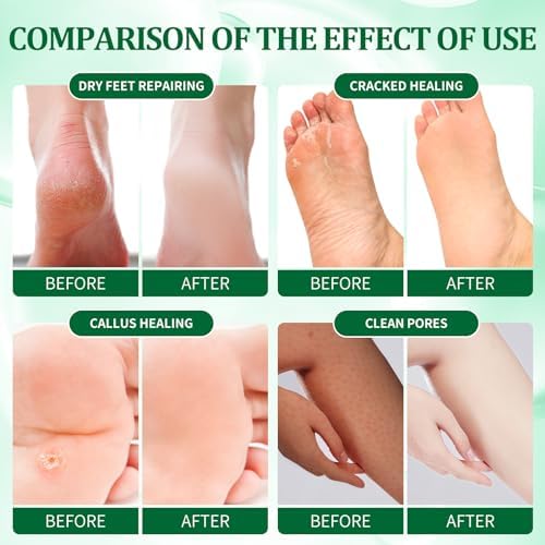 Pedicure Kit Foot Soak Set: Bubble Salt, Sugar Scrub, Massage Mask, Massage Lotion in a Box, 4 Step Foot Spa Kit for Dry Feet, Softens Calluses(3 Set Cucumber) - Image 3