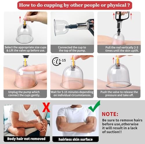 DEFUNX Cupping Set, 32 Cups Cupping Kit for Massage Therapy, Professional Chinese Therapy Set for Back Massage, Pain Relief - Image 5