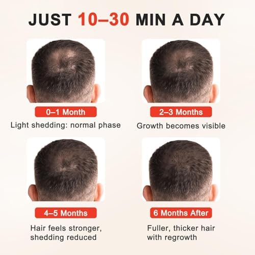Red Light Therapy for Hair Growth for Men & Women,Red Light Hair Growth Cap,Full-Scalp Coverage,At-Home Scalp Care, Father‘s Day Gift Idea,Blue Cap - Image 2
