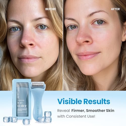 PLANTIFIQUE Ice Roller for Face & Eyes - Reduce Puffiness & Soothe Skin - Image 2