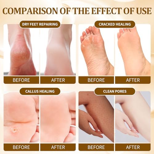 Pedicure Kit Foot Soak Set: Bubble Salt, Sugar Scrub, Massage Mask, Massage Lotion in a Box, 4 Step Foot Spa Kit for Dry Feet,Tired Feet（3 Set Golden petals) - Image 3