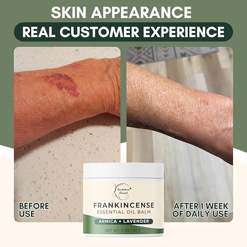Brookethorne Naturals Frankincense Balm with Arnica Montana 2oz - Image 3