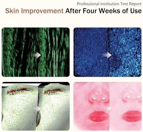 Red Light Therapy Mask for Face, 850nmNIR Treats Acne & Wrinkles - Image 2