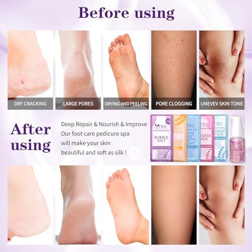 Pedicure Foot Soak Set - Upgraded 6 in 1 Foot Spa, Foot Bath Spa, Pedicure Kit for Tired & Dry Cracked Feet, Athletes Feet, Bad Odor, Softens Calluses (3 Set Lavender) - Image 4
