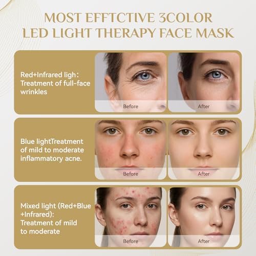 Red Light Therapy for Face Mask,led Red & INR light Treatment Wrinkles Acne - Image 4