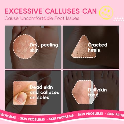 QUIYUM 6 Pairs Watermelon Foot Mask, Moisturizing Booties for Dry Skin - Image 3