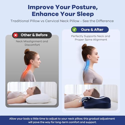 DONAMA Cervical Pillow for Neck Pain, Ergonomic Memory Foam Contour Pillow - Image 2