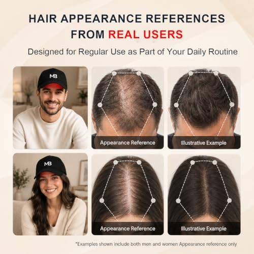 FDA Cleared Red Light Hair Growth Cap for Men and Women, 660nm Red Light Therapy for Hair Growth, Rechargeable & Adjustable for All Hair Type,At-Home Scalp Care - Image 3