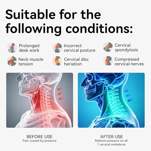 Posture Corrector for Neck & Cervical Spine Alignment - 360° Adjustable Neck Collar with 28 Levels, Memory Foam Support for Pain Relief, Tech Neck, Hump & Forward Head Posture (Gray, X-Large) - Image 2