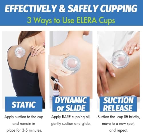 ELERA Silicone Cupping Therapy L Size Sets, Professionally Chinese Massage Cups Tools, Silicone Cup for Joint Pain Relief, Massage Body (L*2 Cups) - Image 5