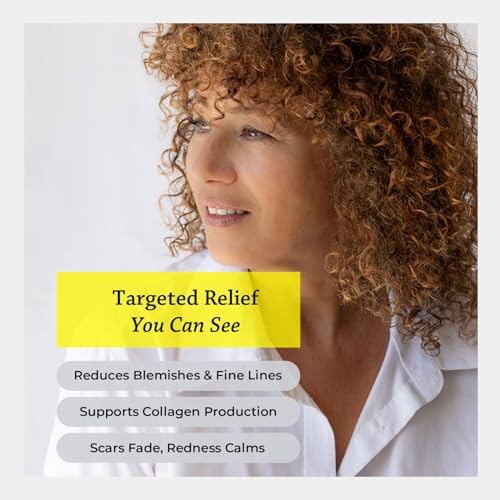 Silk Road Organic Helichrysum Italicum Essential Oil Spray, USDA Certified - Image 2