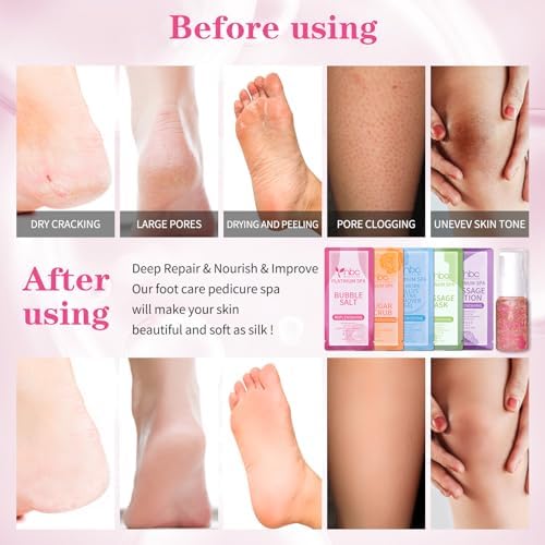 Pedicure Foot Soak Set - Upgraded 6 in 1 Foot Spa, Foot Bath Spa, Pedicure Kit, Foot Soak for Tired & Dry Cracked Feet, Athletes Feet, Bad Odor, Softens Calluses (Rose) - Image 3