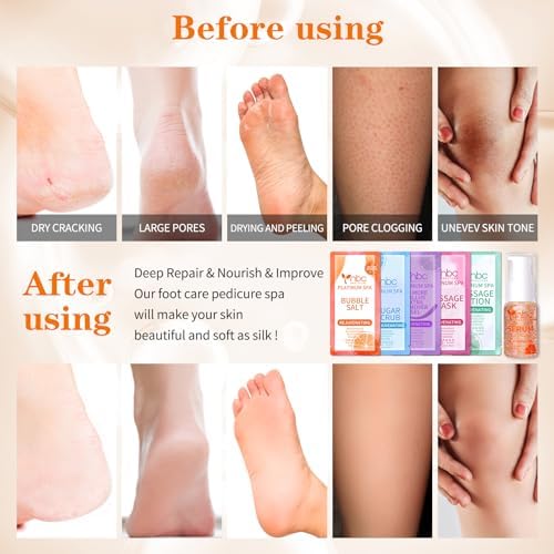 Pedicure Foot Soak Set - Upgraded 6 in 1 Foot Spa, Foot Bath Spa, Pedicure Kit for Tired & Dry Cracked Feet, Athletes Feet, Bad Odor, Softens Calluses (Orange) - Image 3