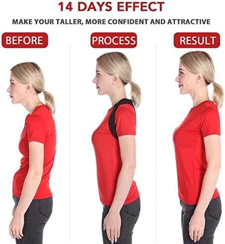 Schiara Posture Corrector for Men and Women, Comfortable Upper and Back Brace, Adjustable Back Support for Back, Shoulder and Neck - Image 2