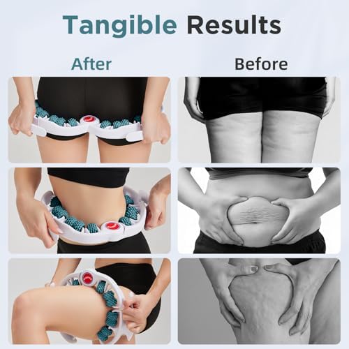 Cellulite Massage Tool - Lymphatic Drainage Massager - Muscle Roller, Deep Fascia Massage, Dimpled Skin Removal, Legs/Thighs/Buttocks, Anti-Cellulite Roller, Smooth Skin (14 Wheel - Green) - Image 2