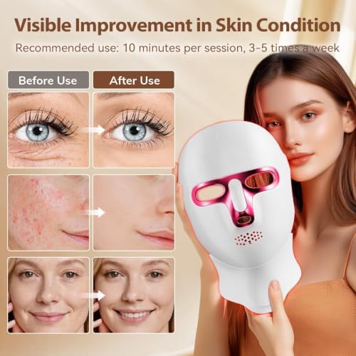 ONLUKY Red Light Therapy Mask USB-C Rechargeable LED Face Mask - Image 3